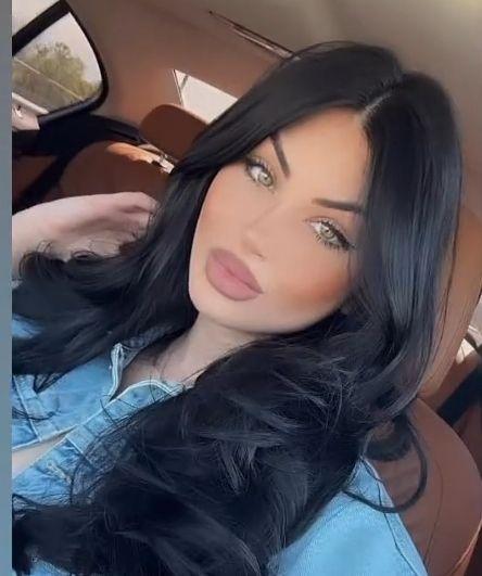Мис България с нова пластика? Изпилиха носа на Тафкова! (ФОТО)