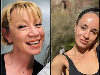 Кака Лара се опъна с ботокс, Радина с устни „ужилени от пчела“