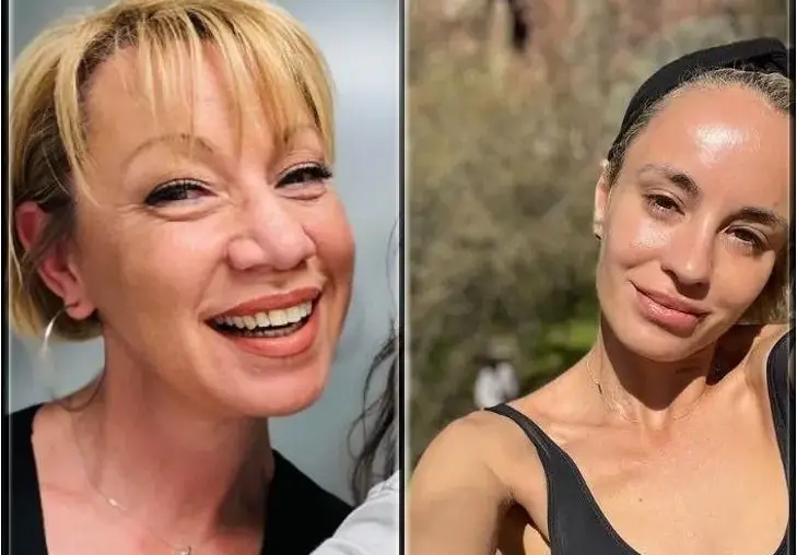 Кака Лара се опъна с ботокс, Радина с устни „ужилени от пчела“