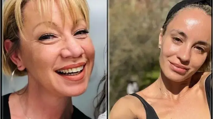 Кака Лара се опъна с ботокс, Радина с устни „ужилени от пчела“