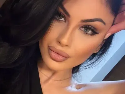 Мис България опъна бръчки с вампирски лифтинг (СНИМКИ)