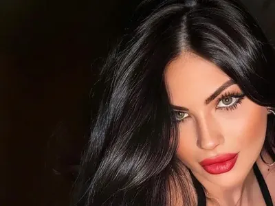 Мис България с нова пластика? Изпилиха носа на Тафкова! (ФОТО)