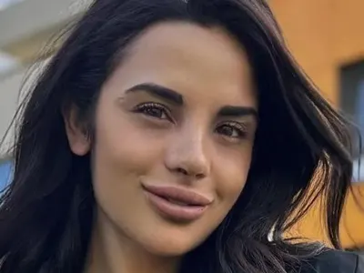 ВАРВАРСКА ринопластика окепази лицето на Ивка Бейбе (СНИМКИ)