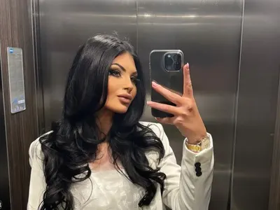 И Мис България се набоцка с опасните инжекции за тен! Стана като морков (СНИМКИ)