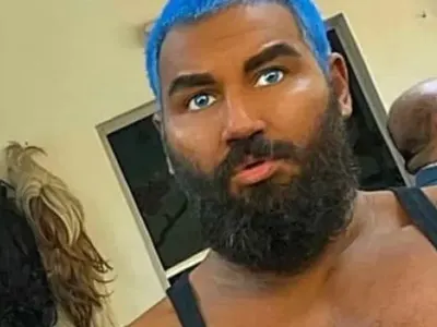 И Мис България се набоцка с опасните инжекции за тен! Стана като морков (СНИМКИ)