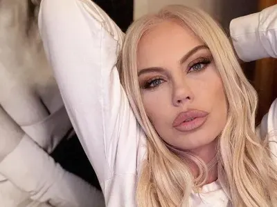 Камелия се обезобрази от пластики! Вижте я без грим (ФОТО)