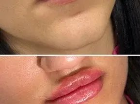 Нарязаната Дебора завърши училище и си изду джуките (СНИМКИ преди и след)