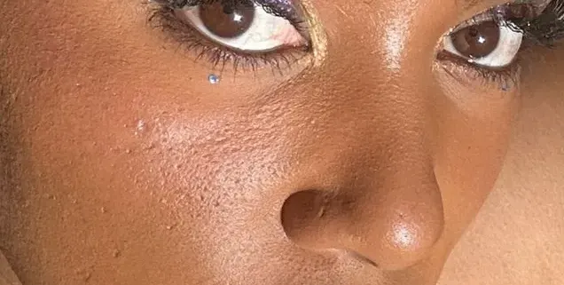 Прея не се притеснява от несъвършенствата по кожата си СНИМКИ