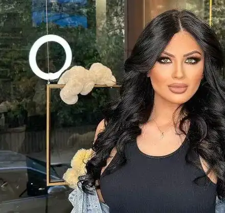 Суета! На 25 години Тафкова лъсна с челен лифтинг! (ФОТО)