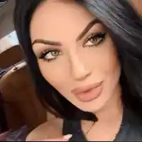 Суета! На 25 години Тафкова лъсна с челен лифтинг! (ФОТО)