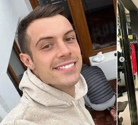 Рекордьор по сакатлъци: Филип Буков с присадена кожа на задните части след падане от мотор