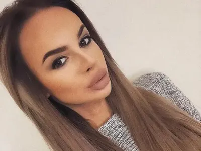 Сузанита с липосукция на брадичката