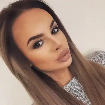 Сузанита с липосукция на брадичката