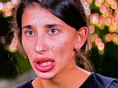 ТОВА ТЯ ЛИ Е? Виктория от „Ергенът“ си оправи зъбите (СНИМКИ Преди и след)