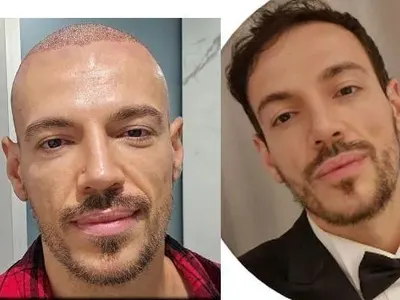 Дани Петканов най-сетне показа БУЙНИ коси! Струваха му 20 бона!