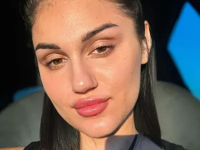 Нарязаната Дебора показа белезите на плажа СНИМКИ