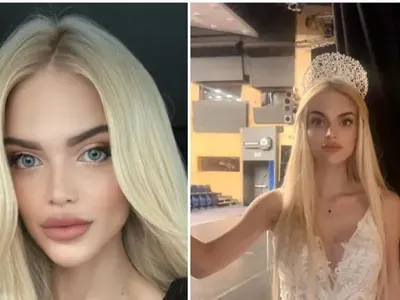 Спипаха крадеца, който обра Мис България докато лежи в ИСУЛ