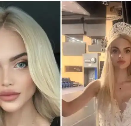 Спипаха крадеца, който обра Мис България докато лежи в ИСУЛ