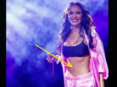 Мария с ужасяващ корем: Изсъхнала кожа и белези от липосукции (СНИМКИ)