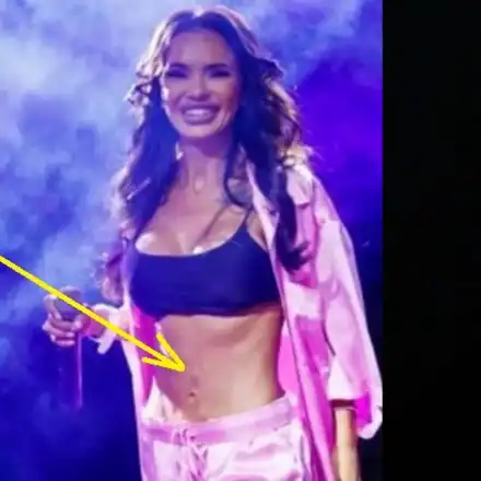 Мария с ужасяващ корем: Изсъхнала кожа и белези от липосукции (СНИМКИ)