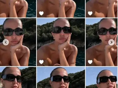 Последни брутални ВИП пластики: Николета наду устни, а Моника Валериева пак клъцна носа