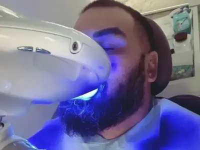 Азис си избели зъбите