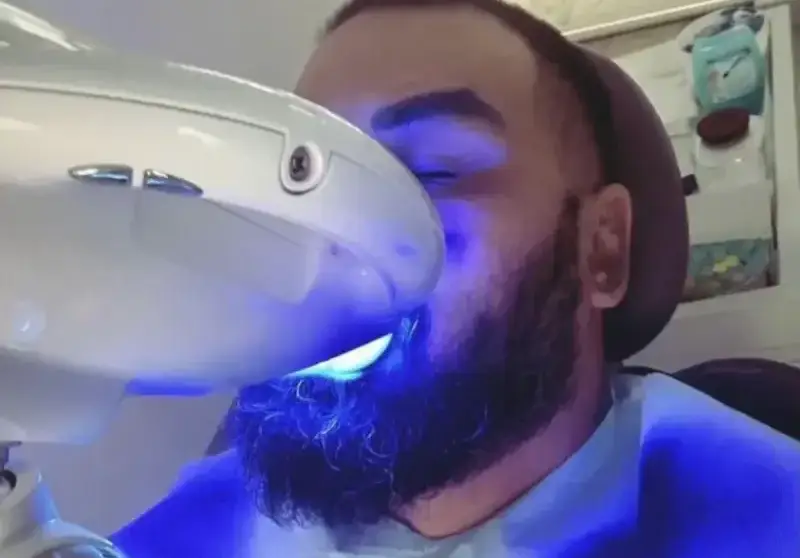 Азис си избели зъбите