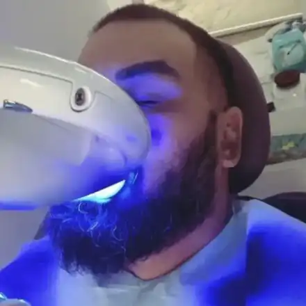 Азис си избели зъбите