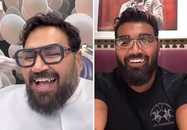 Азис си направи вампирска усмивка