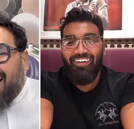 Азис си направи вампирска усмивка