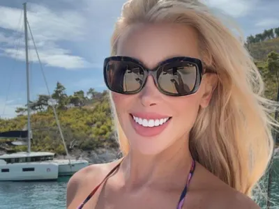 Кофти хиалурон обезобрази Антония Петрова! Вижте какво си причини