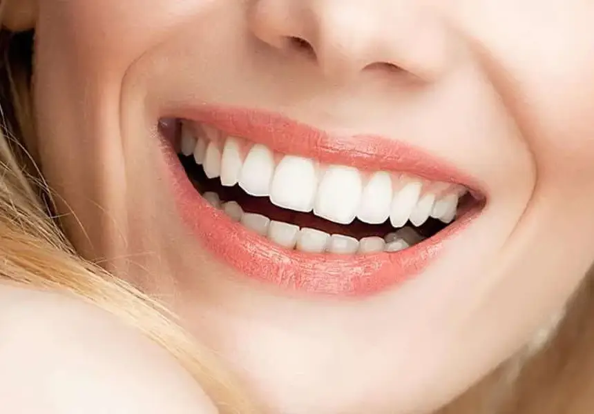 Професионално или домашно избелване на зъби: Коя опция е най-подходяща за вас?