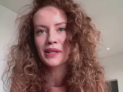 Гери Малкоданска се ОБЕЗОБРАЗИ!  Челото й е изпъкнало, лицето подпухнало...