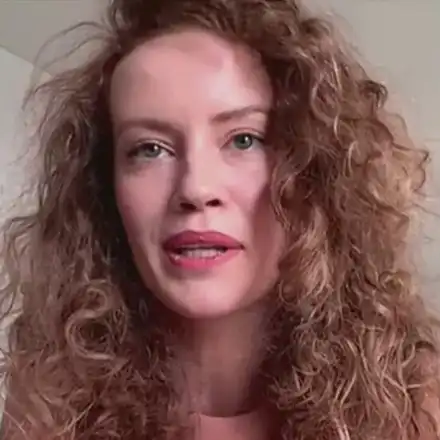 Гери Малкоданска се ОБЕЗОБРАЗИ!  Челото й е изпъкнало, лицето подпухнало...