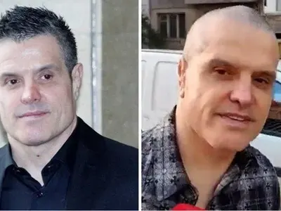 НЕ Е ЗА ВЯРВАНЕ: Брендо прави зъби в топклиника! ВИДЕО