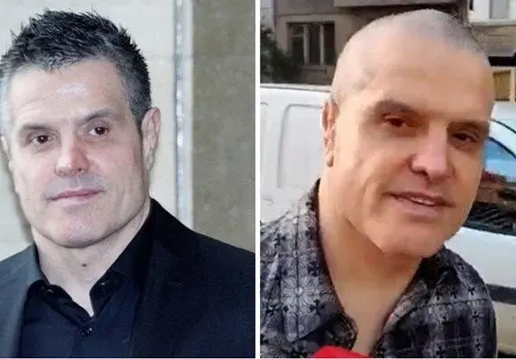 НЕ Е ЗА ВЯРВАНЕ: Брендо прави зъби в топклиника! ВИДЕО