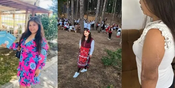 Болката на една тийнейджърка: Катя се бори за живота на ръката си