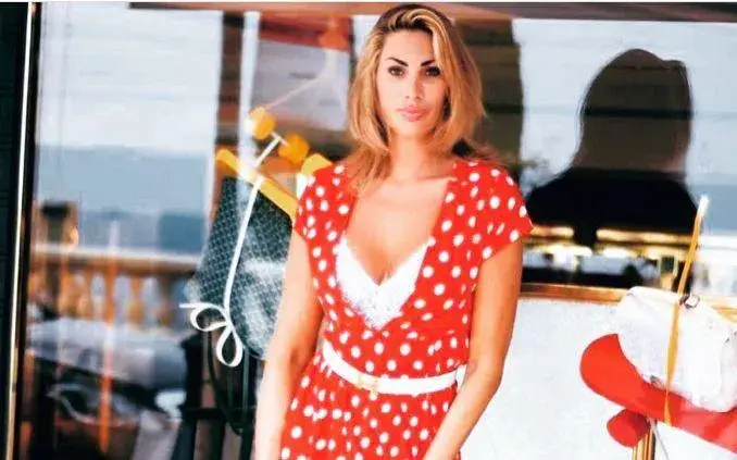 Ивон от Биг Брадър крие белег от операция на адамова ябълка (СНИМКИ)