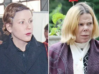 На косъм от смъртта: Лекарска грешка обезобразила княгиня Калина