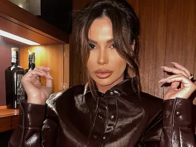 Оплешивява? Моника Валериева сгъстява косата си