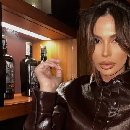 Оплешивява? Моника Валериева сгъстява косата си