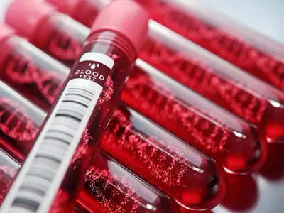 При гъста кръв може да умрем: Ето кои 5 напитки я разреждат