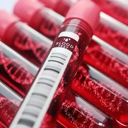 При гъста кръв може да умрем: Ето кои 5 напитки я разреждат