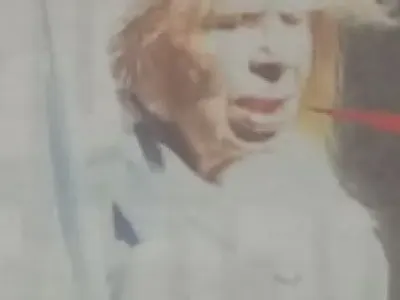 УЖАС! Лицето на Лили се разпада (СНИМКИ за хора със здрави нерви)