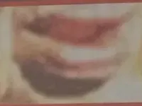 УЖАС! Лицето на Лили се разпада (СНИМКИ за хора със здрави нерви)