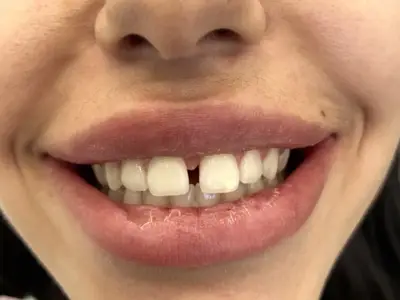 Д-р Ибрахим Бялев: Красивата усмивка може да промени самочувствието и качеството ни на живот