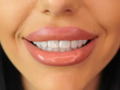 Д-р Ибрахим Бялев: Красивата усмивка може да промени самочувствието и качеството ни на живот