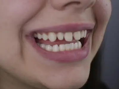 Д-р Ибрахим Бялев: Красивата усмивка може да промени самочувствието и качеството ни на живот