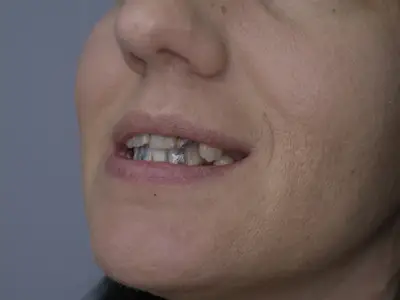 Д-р Ибрахим Бялев: Красивата усмивка може да промени самочувствието и качеството ни на живот