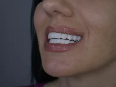 Д-р Ибрахим Бялев: Красивата усмивка може да промени самочувствието и качеството ни на живот